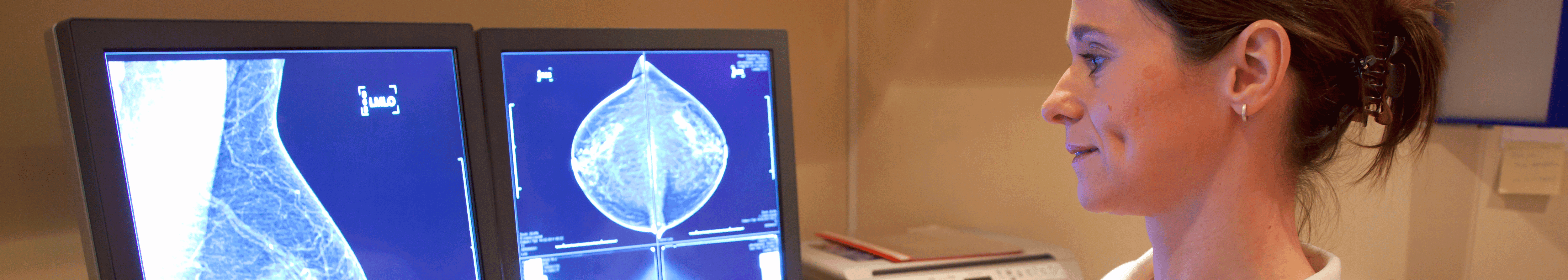 mammogram machine reading radiologist